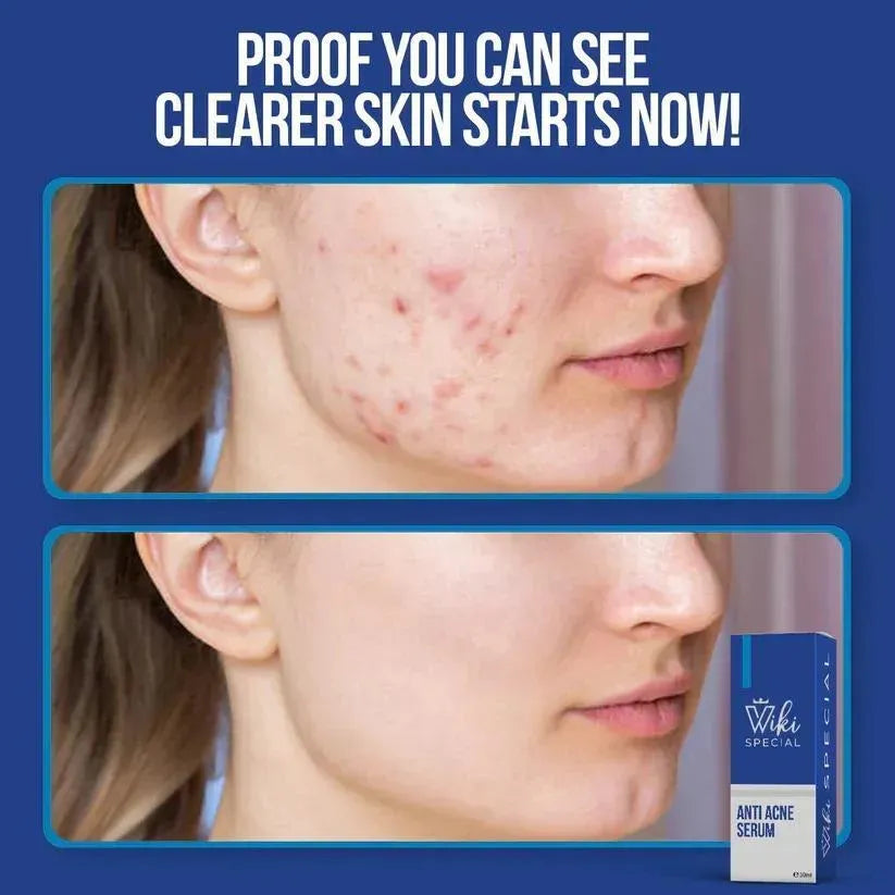 Viki Skin Brightining serum